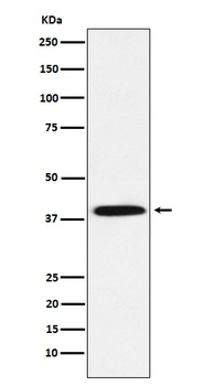 Phospho-IKB alpha/IKB Rabbit Monoclonal Antibody