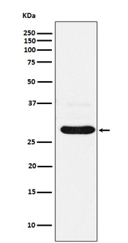 CHMP2B Rabbit Monoclonal Antibody