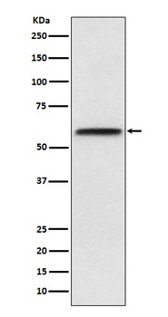 LCAT Rabbit Monoclonal Antibody