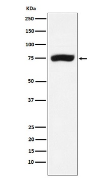 XPD Rabbit Monoclonal Antibody