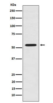 LMAN1 Rabbit Monoclonal Antibody