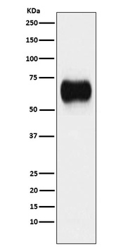 MICA Rabbit Monoclonal Antibody