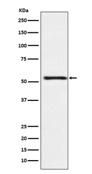 ATP4B Rabbit Monoclonal Antibody