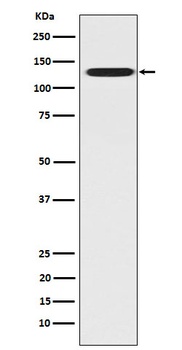 CC2D1A Rabbit Monoclonal Antibody