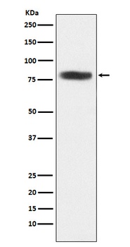 CARS Rabbit Monoclonal Antibody