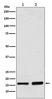 AP2S1 Rabbit Monoclonal Antibody