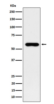 SUOX Rabbit Monoclonal Antibody