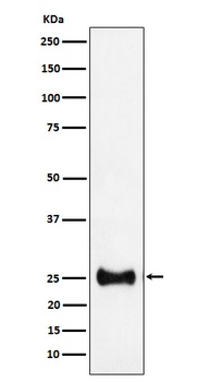 Adenylate kinase 4 Rabbit Monoclonal Antibody