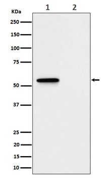 Phospho-MLKL/MLKL Rabbit Monoclonal Antibody