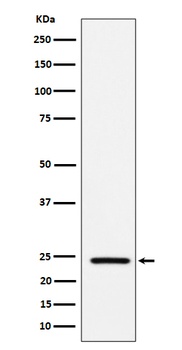 SOD2 Rabbit Monoclonal Antibody