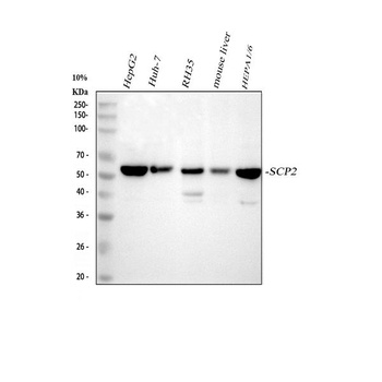 Sterol carrier protein 2 Rabbit Monoclonal Antibody