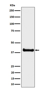 ALS2CR1 Rabbit Monoclonal Antibody