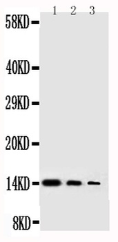 Beta-nerve growth factor NGF Rabbit Polyclonal Antibody