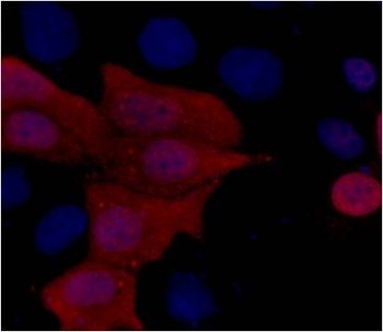 His-Tag Mouse mAb Antibody