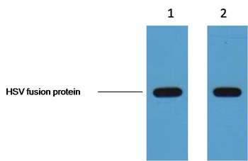 HSV-Tag Mouse mAb Antibody