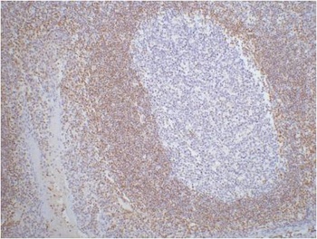 Bcl-2 Mouse mAb Antibody