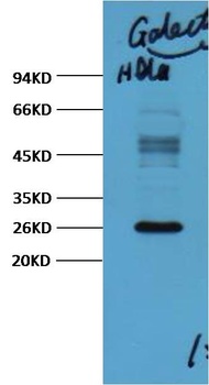 Galectin-3 Mouse mAb Antibody