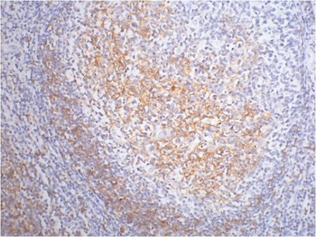 CD23 Mouse mAb Antibody