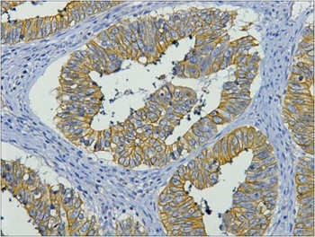CK19 Mouse mAb Antibody