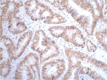 p53 Mouse mAb Antibody