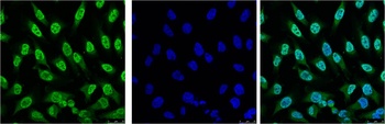 p53 Mouse mAb Antibody