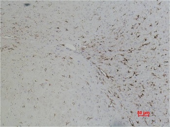 GFAP Mouse mAb