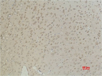 Aquaporin 4 Mouse mAb Antibody