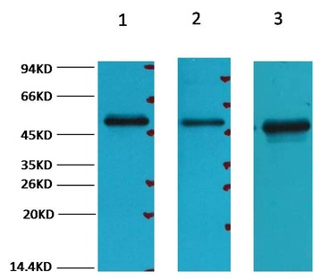 FH/Fumarase Mouse mAb Antibody