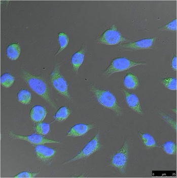 FH/Fumarase Mouse mAb Antibody