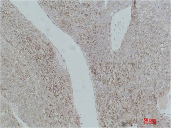 AFP/alpha 1 Fetoprotein Mouse mAb Antibody