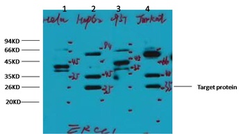 ERCC1 Mouse mAb Antibody