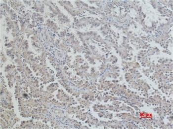 ERCC1 Mouse mAb Antibody