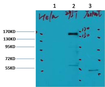 ErbB-2/HER-2 Mouse mAb
