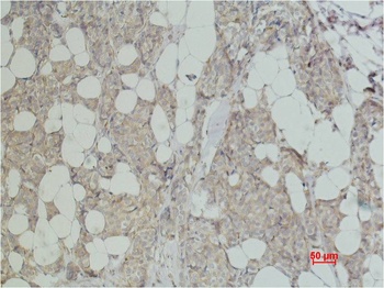 ErbB-2/HER-2 Mouse mAb