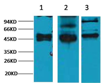 CK17 Mouse mAb Antibody