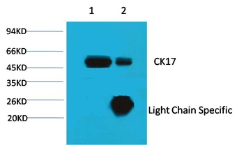 CK17 Mouse mAb Antibody