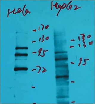 IDE/Insulin Degrading Enzyme Mouse mAb Antibody