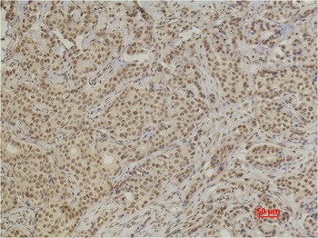 XRCC4 Mouse mAb Antibody