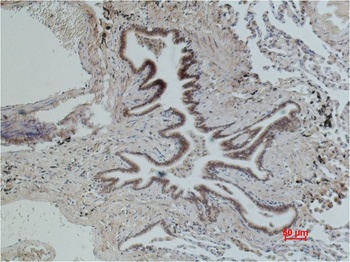 CD16 Mouse mAb Antibody