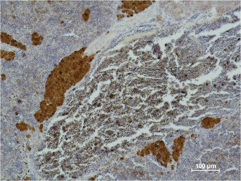 CD25 Mouse mAb Antibody