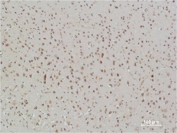 NFkB p65 Mouse mAb Antibody