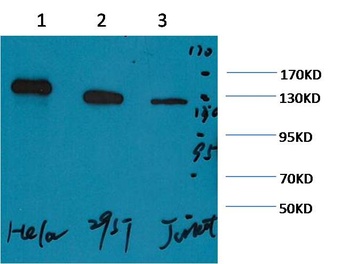 PARP Mouse mAb Antibody