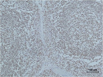 PARP Mouse mAb Antibody