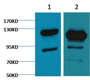 Cleaved PARP Mouse mAb Antibody