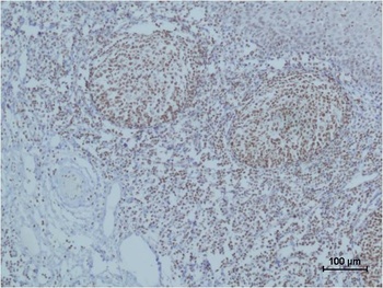 Cleaved PARP Mouse mAb Antibody
