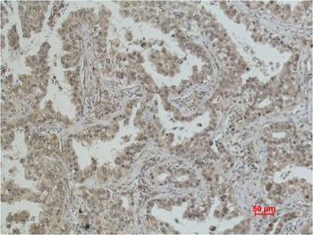 eIF4A1 Mouse mAb Antibody