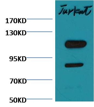 Cleaved PARP Mouse mAb Antibody