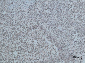 Cleaved PARP Mouse mAb Antibody