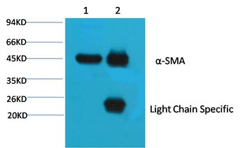 α skeletal muscle actin Mouse mAb Antibody