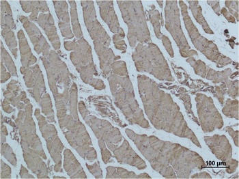 α skeletal muscle actin Mouse mAb Antibody